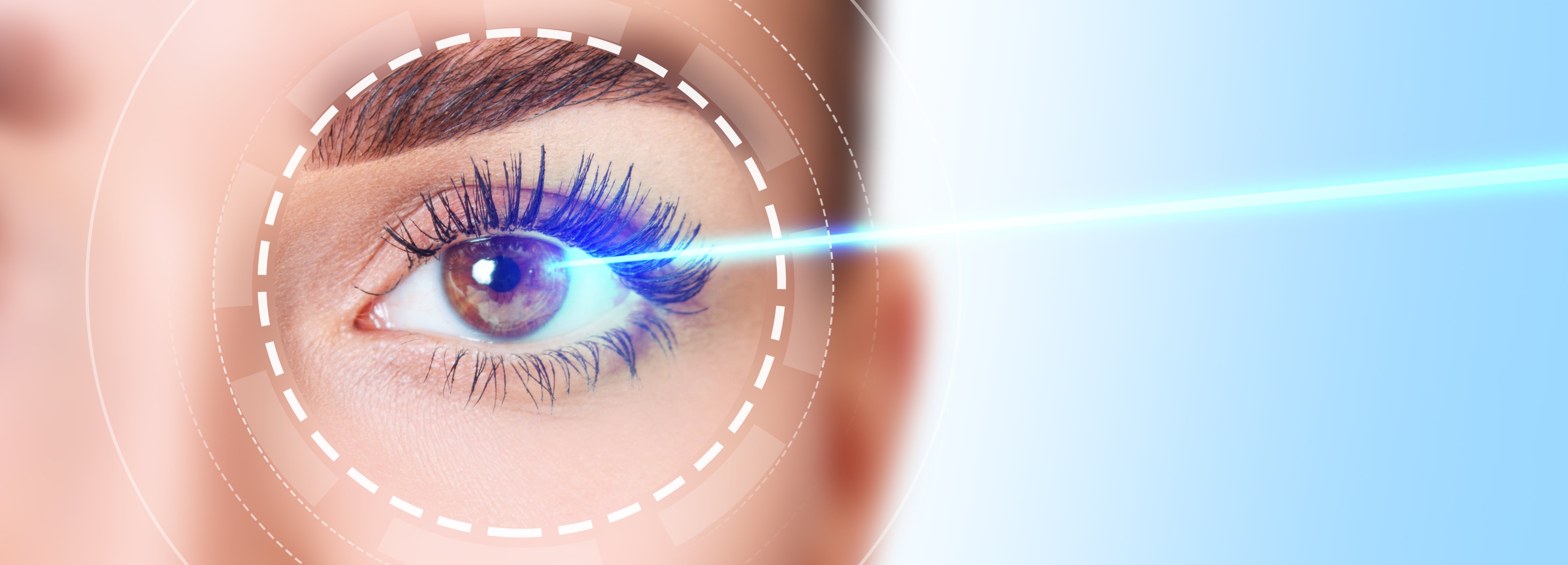Laser Vision Correction